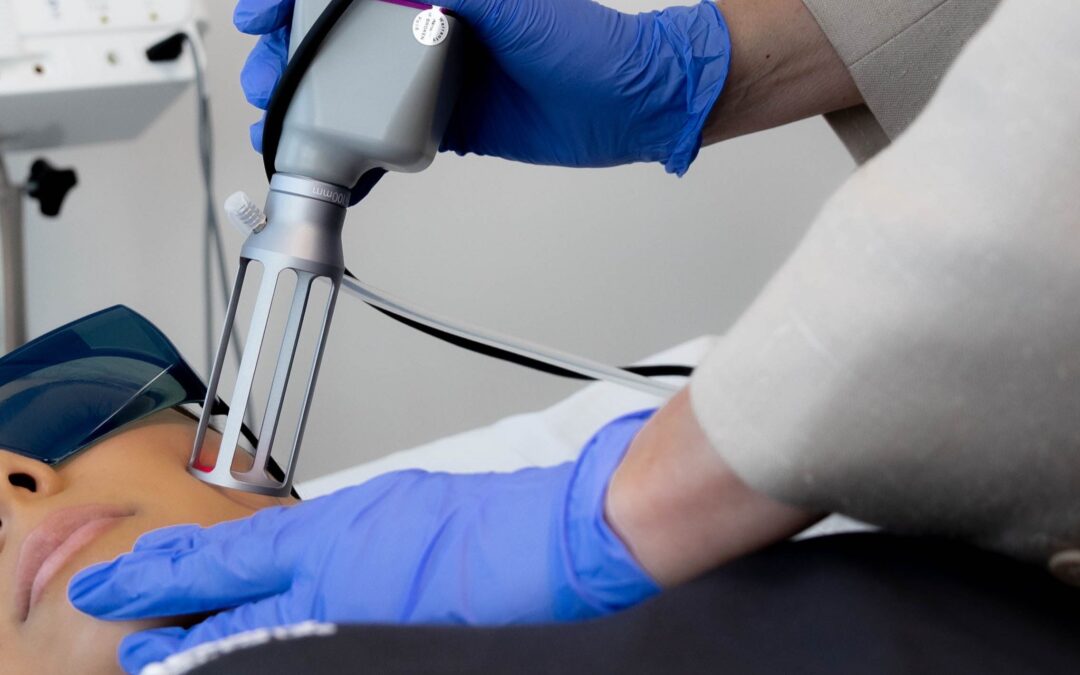 How To Care For Your Skin After CO2 Treatment