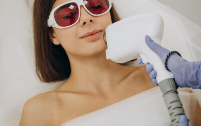 IPL Vs Laser For Pigmentation