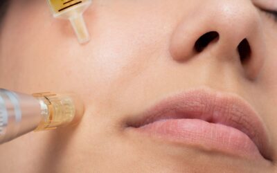 Needle It Or Leave It? The Benefits Of Skin Needling