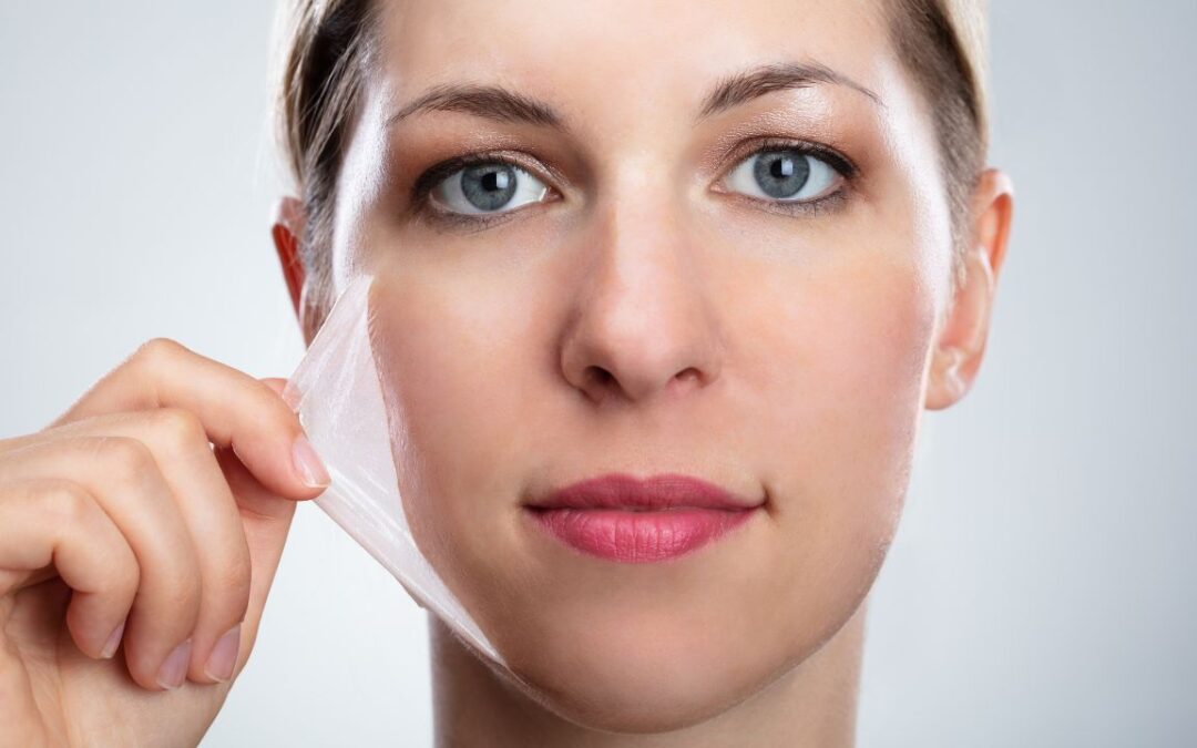 Types of chemical peels